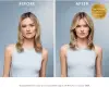MOROCCANOIL TREATMENT שמן טיפולי לייט לשיער - מהדורת אירוויזיון